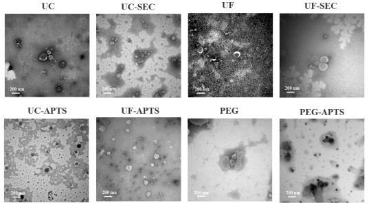 Transmission electron microscopy grid comparing vesicle morphology from eight combined isolation methods for Fusarium oxysporum extracellular vesicles, highlighting optimal cup-shaped bilayer membranes from ultracentrifugation-SEC.
